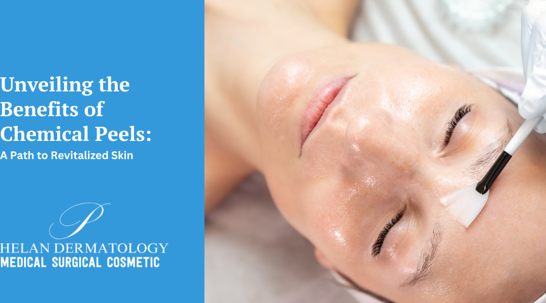 Unveiling the Benefits of Chemical Peels: A Path to Revitalized Skin