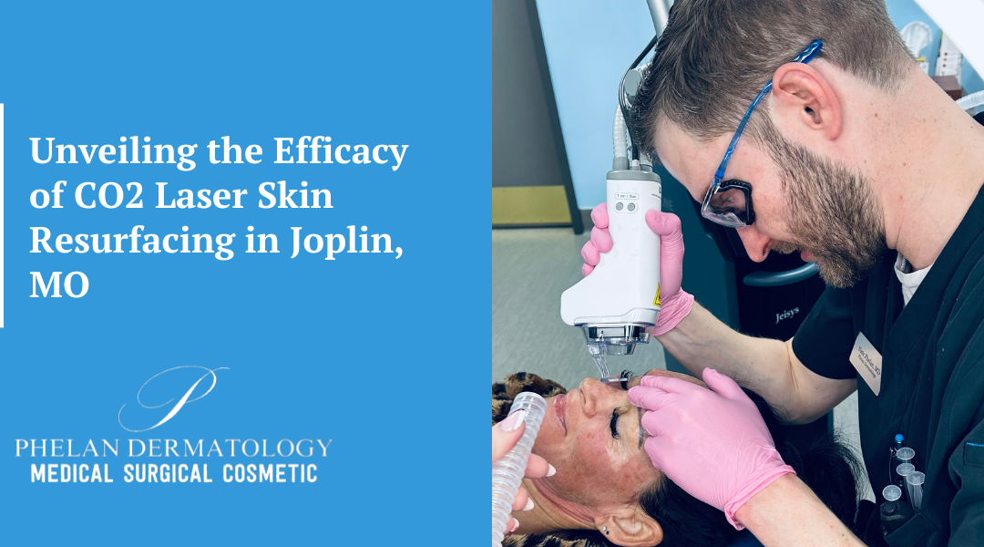 Unveiling the Efficacy of the Best CO2 Laser Skin Resurfacing in Joplin, MO