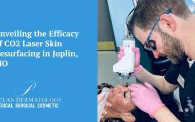 Unveiling the Efficacy of the Best CO2 Laser Skin Resurfacing in Joplin, MO