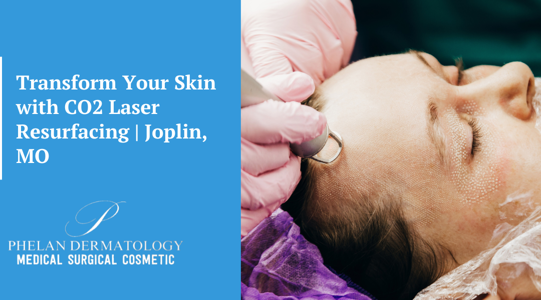 Transform Your Skin with CO2 Laser Resurfacing | Joplin, MO