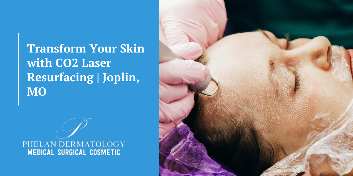 Transform Your Skin with CO2 Laser Resurfacing | Joplin, MO