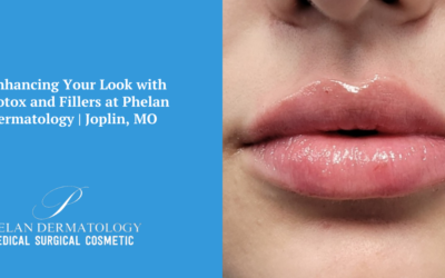 Enhancing Your Look with Botox and Fillers at Phelan Dermatology | Joplin, MO