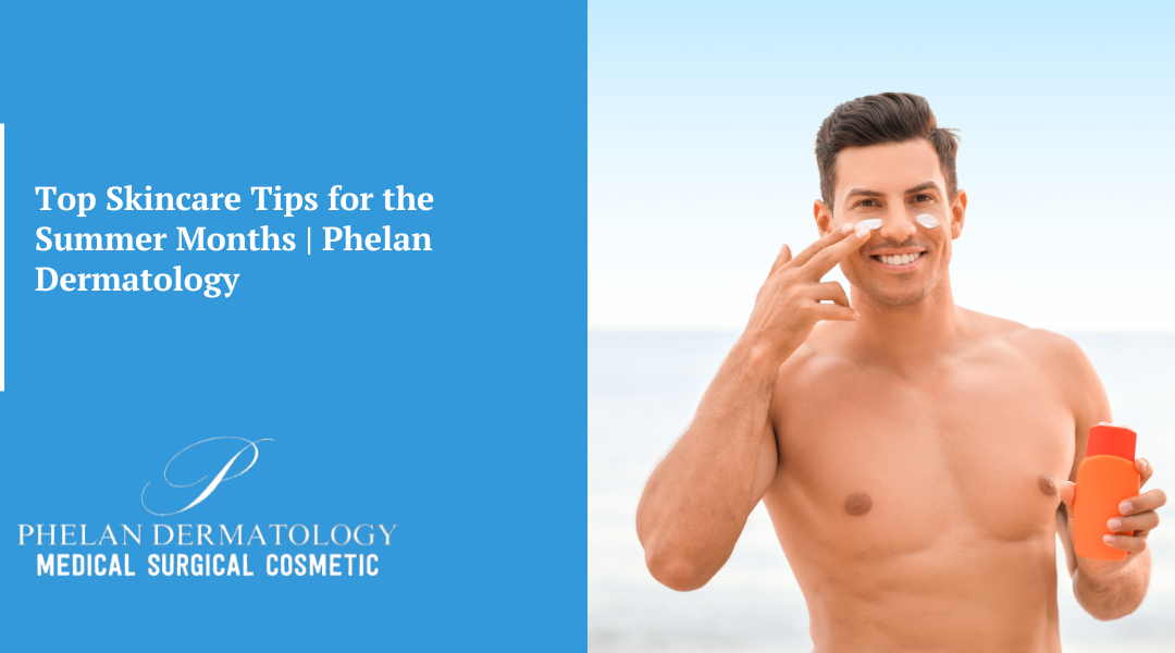 Top Skincare Tips for the Summer Months | Phelan Dermatology
