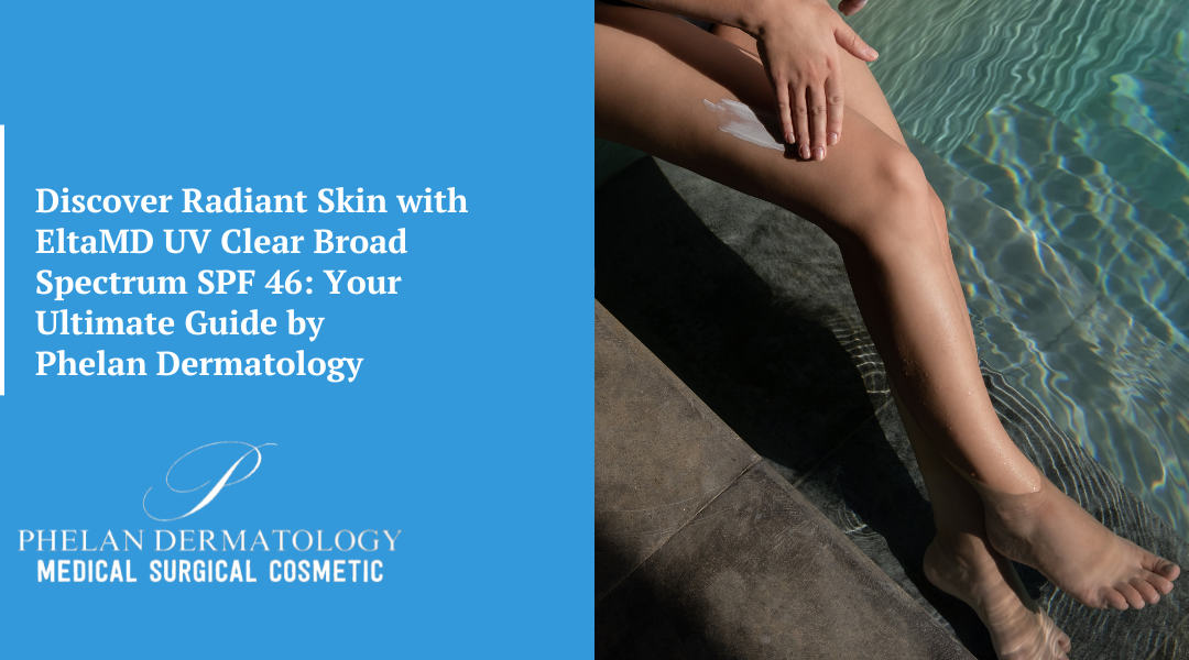 Discover Radiant Skin with EltaMD UV Clear Broad Spectrum SPF 46: Your Ultimate Guide by Phelan Dermatology
